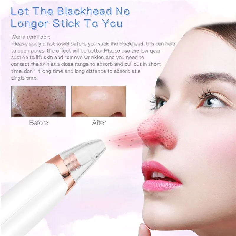 Elektroninis veido porų valiklis "Luxury Peeling Beauty"