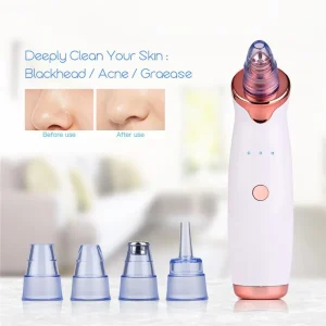 Elektroninis vakuminis veido odos valiklis "Skin Rejuvenation